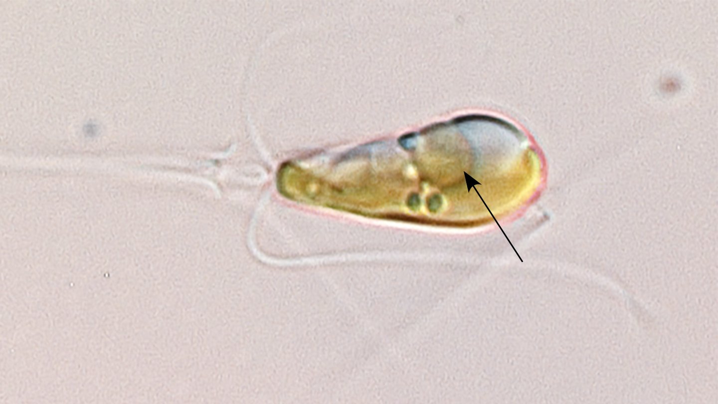 nitrogen-fixing organelle in alga