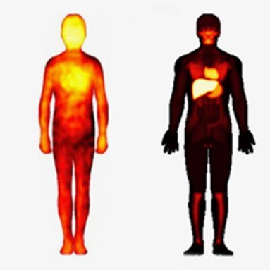 Two outlines of bodies shown next to one another feature varying patterns of orange highlights.